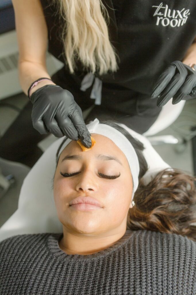 chemical-peel-denver-boulder